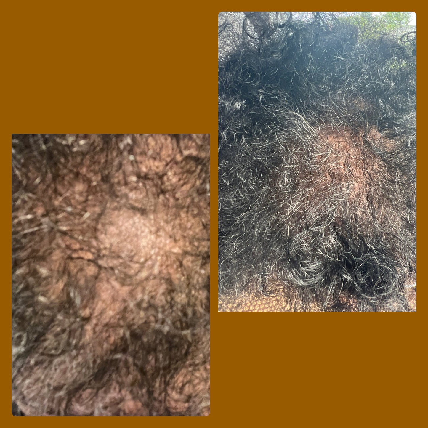 Hair Growth oil