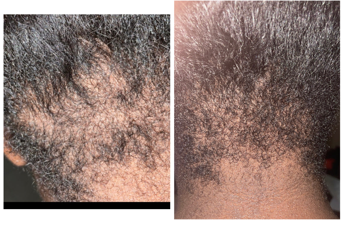 Hair Growth oil