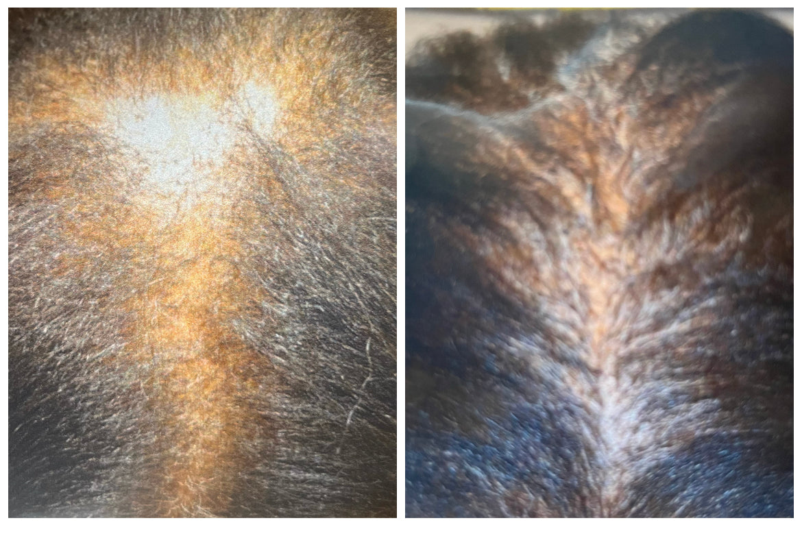 Hair Growth oil