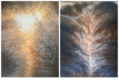 Hair Growth oil